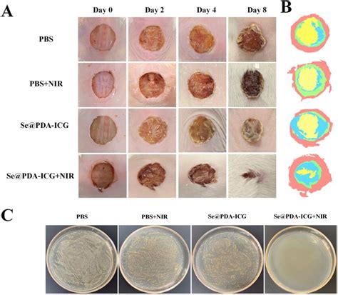 In Vivo Antibacterial Activity Of Se Pda Icg Under Wound Healing Model