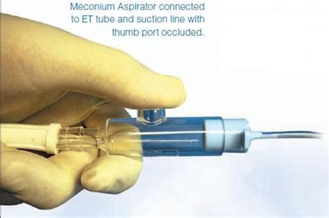 Neotech Meconium Aspirators