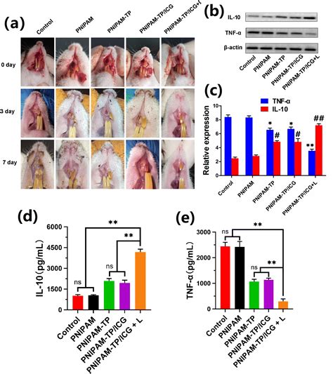 A Multifunctional Thermosensitive Hydrogel Based On Phototherapy For