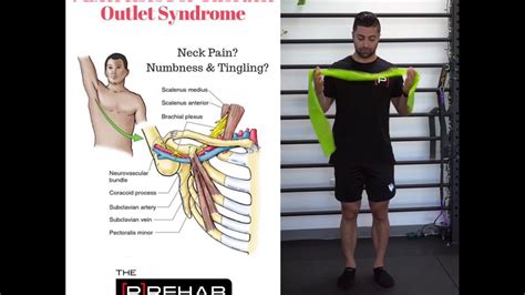 7 Exercises For Thoracic Outlet Syndrome Youtube