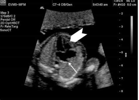 Unit Test Thoracic Anatomy Introduction To Echo And Fetal Echo