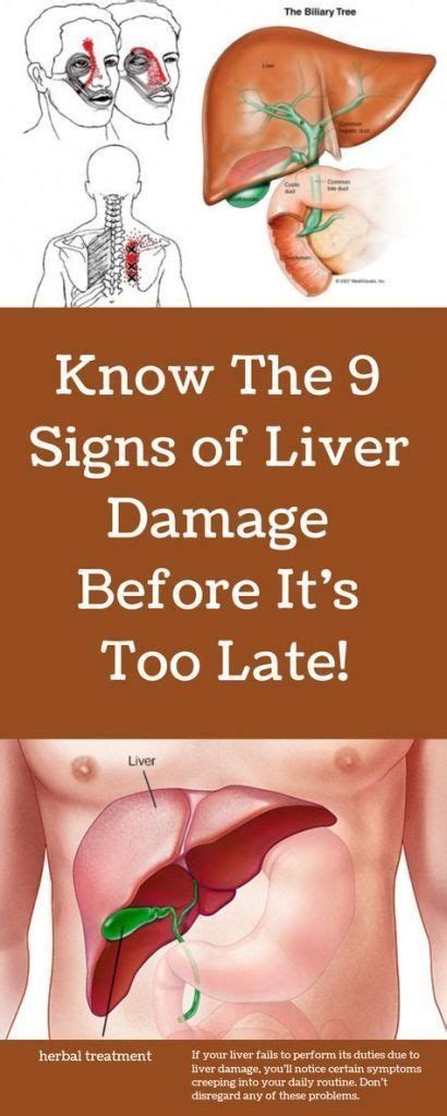 Signs Of A Bad Liver In Humans