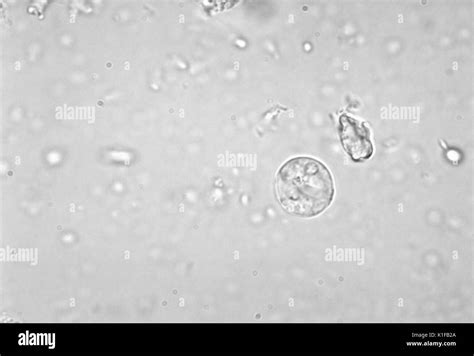 Entamoeba Histolytica Cyst Schwarzweiß Stockfotos Und Bilder Alamy