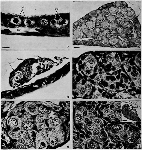 Figure 1 From Histological Studies On The Sex Differentiation In