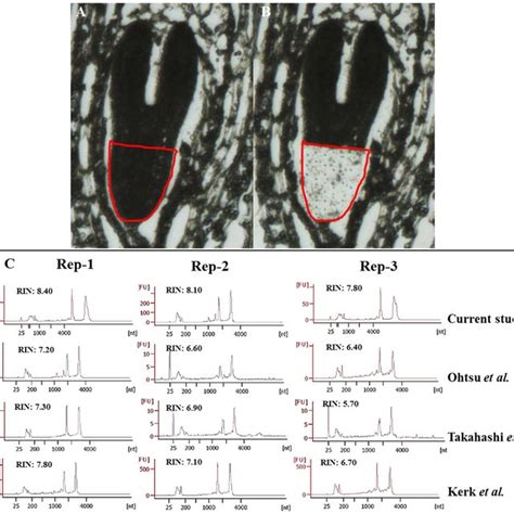 RNA Isolation From LCM Derived Tissue And The Quality Check Using Bio