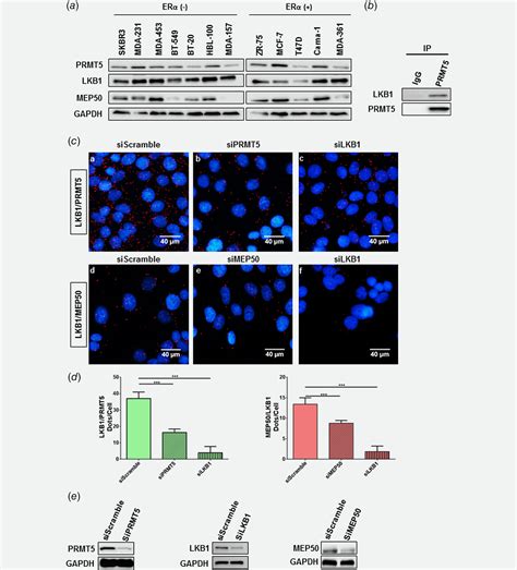 LKB1 Regulates PRMT5 Activity In Breast Cancer Lattouf 2019