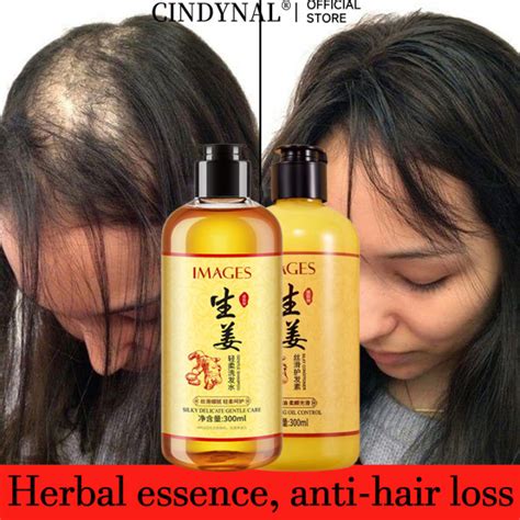 Cindynal Ginger Hair Shampoo Anti Hair Loss Nourish Hair Fast Growth