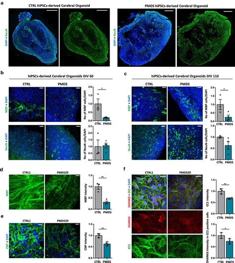 Human Cerebral Organoids Recapitulate The MBP Changes Seen In Vivo A