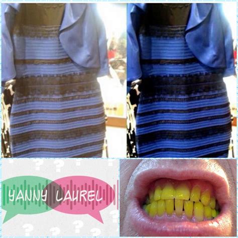 First There Was The Dress Colorthen Yanny Or Laurel What Color Are The Teeth Yellow Or