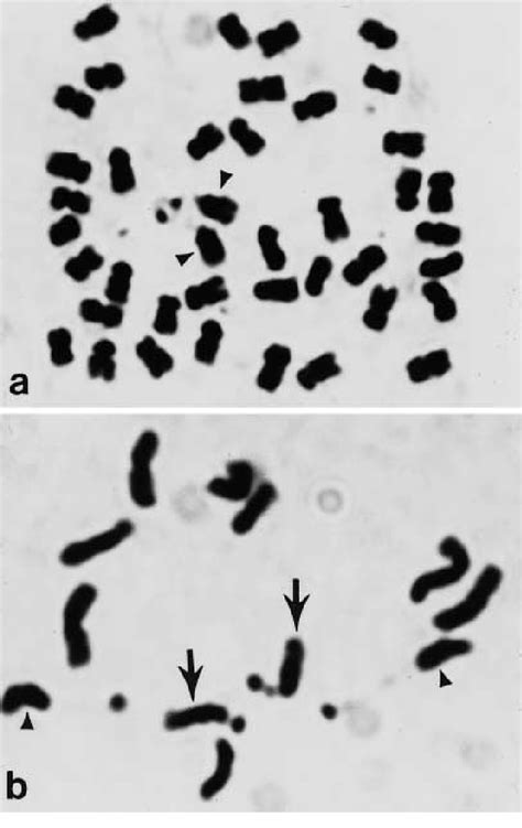 A B Feulgen Stained Mitotic Metaphase Chromosomes Of G Tomentella