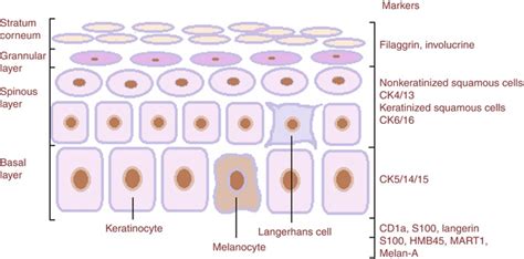 Immunohistochemistry Of Cancers Oncohema Key