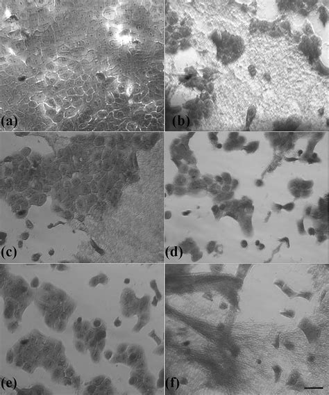 Morphology Of Hacat Cells Grown In Control And Collagen Zntio