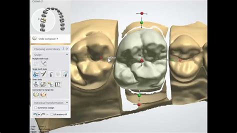 Intro To Dental Cadcam The Tools Youtube