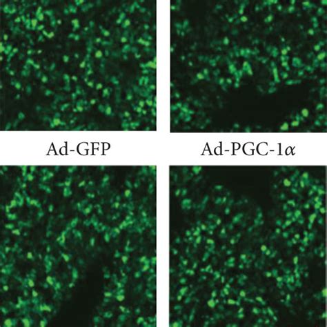 Hepatic I R enhances the in situ expression of PGC 1α and transduction