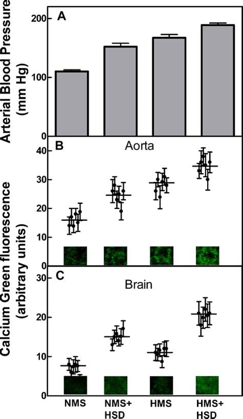 Effect Of HSD Treatment On Ca 2 I In Aortic Smooth Muscle And Brain