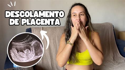 Descolamento De Placenta Semanas Tive Sangramento Youtube