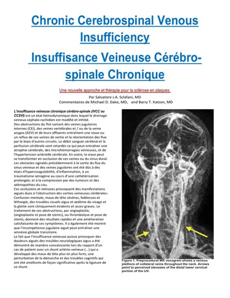 Can Chronic Cerebrospinal Venous Insufficiency Be Cured Honjok Me