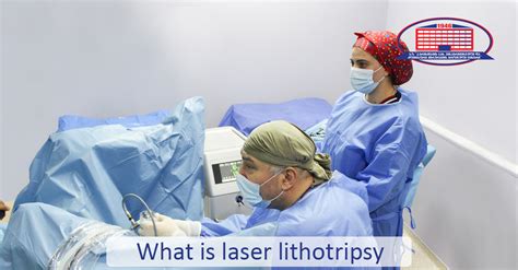 Dissolving Stones With Laser Laser Lithotripsy The Most Innovative