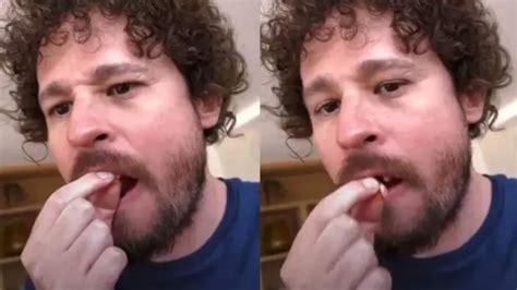 En Plena Transmisión En Vivo Luisito Comunica Perdió Dos Dientes Sus Seguidores Se Preocuparon