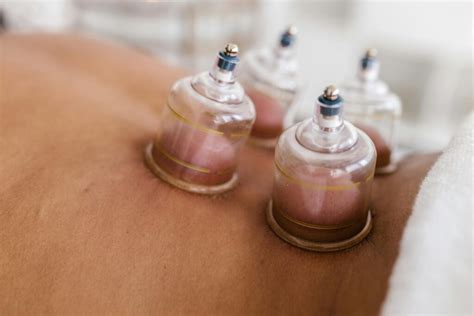 Cupping Therapy Explained Benefits Risks And Techniques