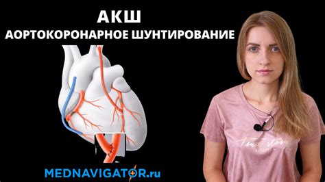 АКШ - аортокоронарное шунтирование | Лечение ИБС (ишемической болезни ...
