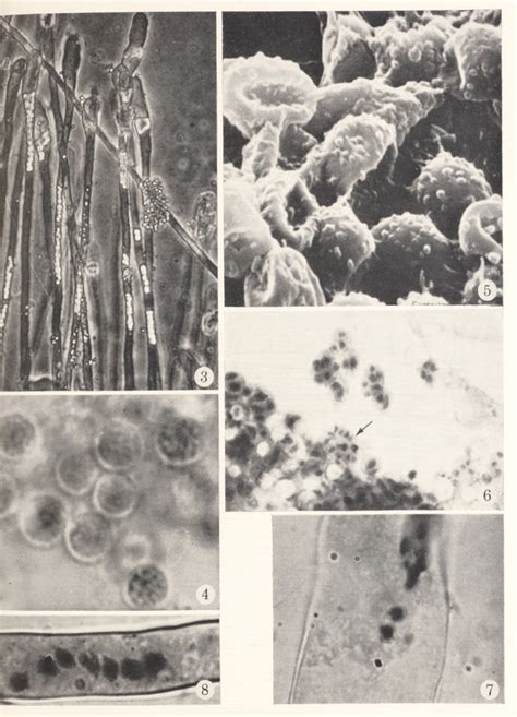 The Life History Of Plasmodiophora Brassicae Woron Semantic Scholar