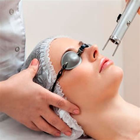 Q Switch Laser Cosmetic Laser Skin Clinic