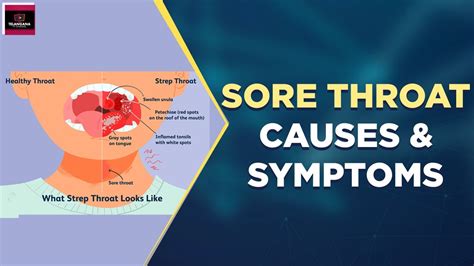 Sore Throat Causes And Symptoms Sore Throat Remedies Sore Throat