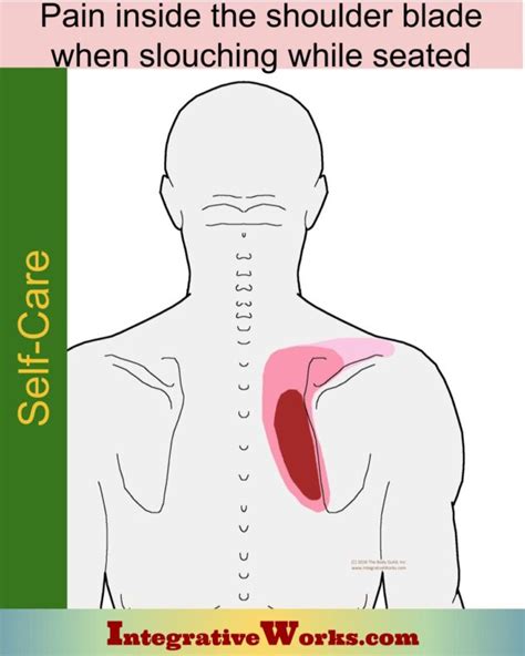 Pain Between Shoulder Blades: Pain Patterns, Causes, Self-Care ...