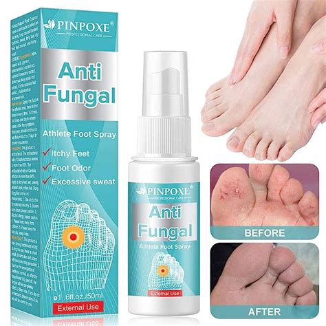 Buy Athletes Foot Spray Antifungal Deodorant Antifungal Foot Spray