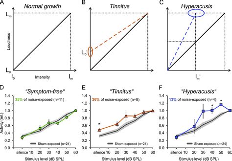 Enhanced Central Neural Gain Compensates Acoustic Trauma Induced