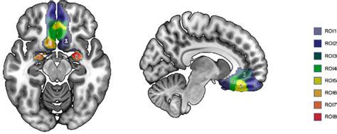 Region Of Interest Mask Of The Ventromedial Prefrontal Cortex Roi 1 6