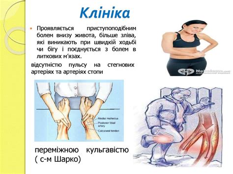 Рідкісні симптоми та синдроми в клініці внутрішніх хвороб - online ...