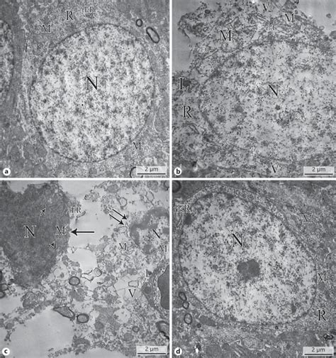 Tem Of Granule Cells A Control Group Showing A Granule Cell With A