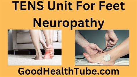 Tens Unit For Feet Neuropathy An Effective Complimentary Treatment