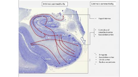 Macroscopic Image Of The Hippocampal Formation From A Normal Control