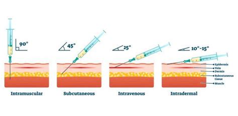 Intramuscular And Intradermal Injection Quiz Test