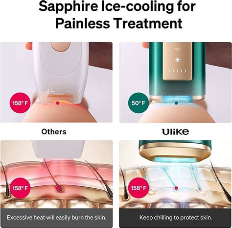 Ulike Sapphire Air Ipl Hair Removal Handset With Ice Cooling