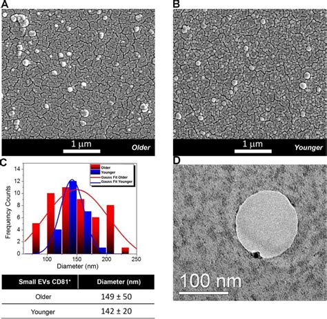 Morphological And Molecular Characterization Of Extracellular Vesicles