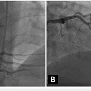 Coronary Angiogram From Clinical Case 1 A Standard Angiographic View