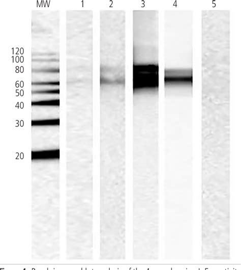 Figure From Sensitization To Gibberellin Regulated Protein