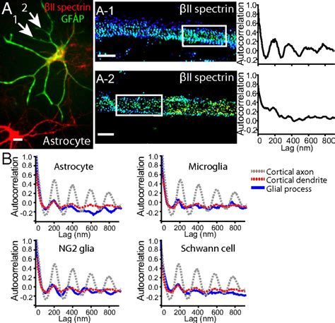 Prevalent Presence Of Periodic Actinspectrin Based Membrane Skeleton