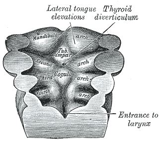 Persistent thyroglossal duct - Wikiwand