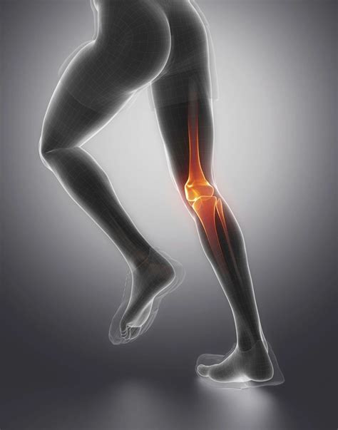 ACL INJURY: 8 Essential ACL Rehab Exercises