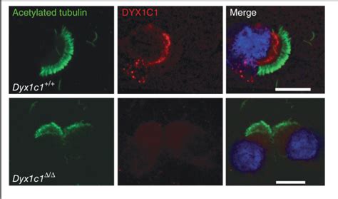 Figure 1 1 From The Role Of DYX1C1 In Motile Cilia And Axonemal Dynein