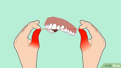 10 pasos para usar hilo dental Clínica U P L A