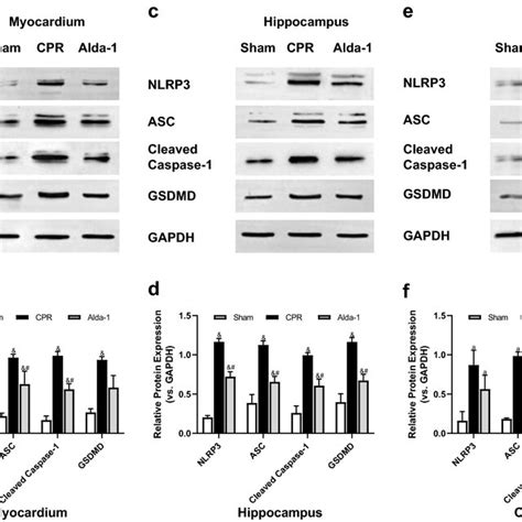 Expression Of Pyroptosis Related Proteins In The Myocardium