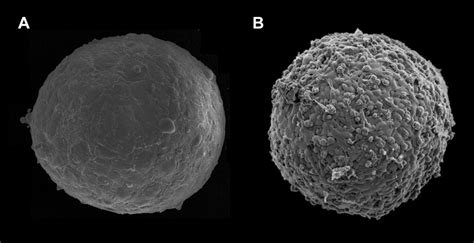 Physics Cellular Aggregates Under Pressure