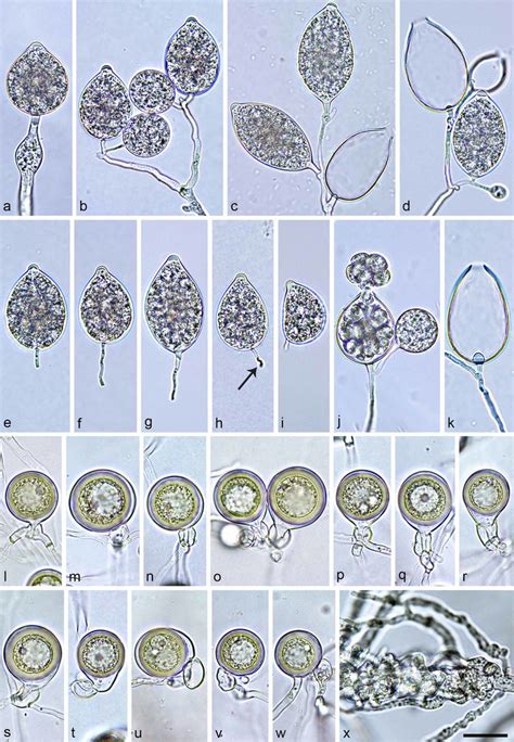 Morphological Structures Of Phytophthora Kernoviae A K Sporangia With