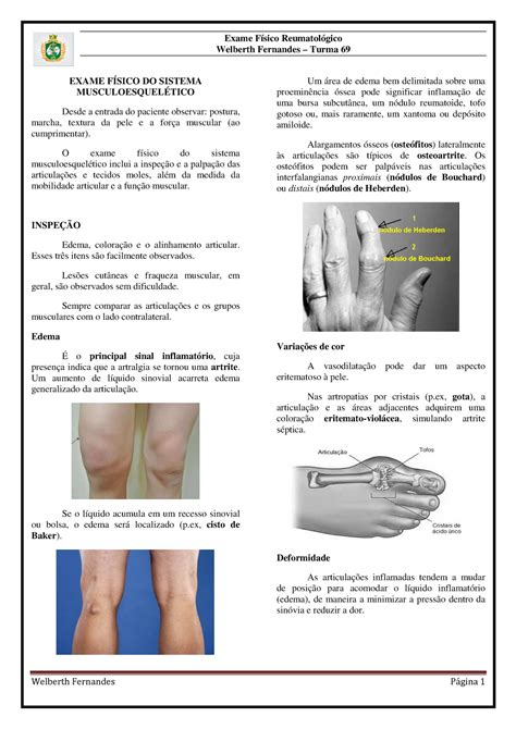 Semiologia reumatológica Exame Físico Reumatológico Welberth